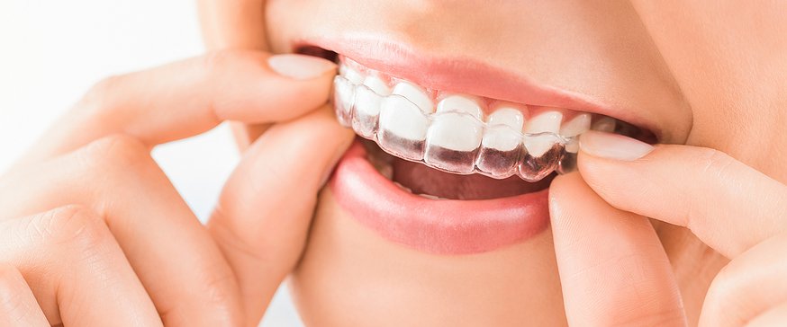 Invisalign Doctor Login: A Guide for Dental Professionals